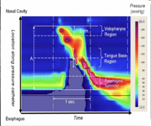 High resolution Manometry image